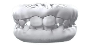Crooked teeth case photo
