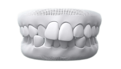 Crowded teeth case photo