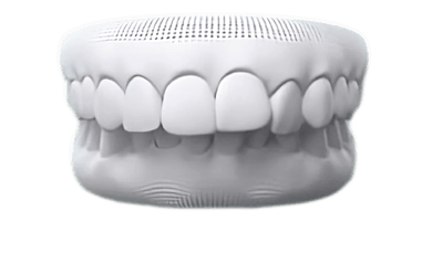 Deep bite case photo