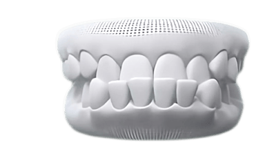 Underbite case photo