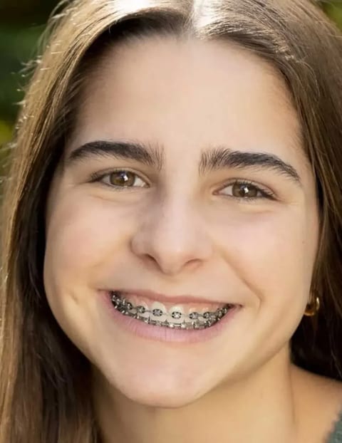 Teen smiling with braces