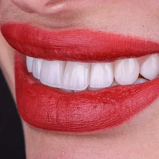 Fixed and Removable Dentures