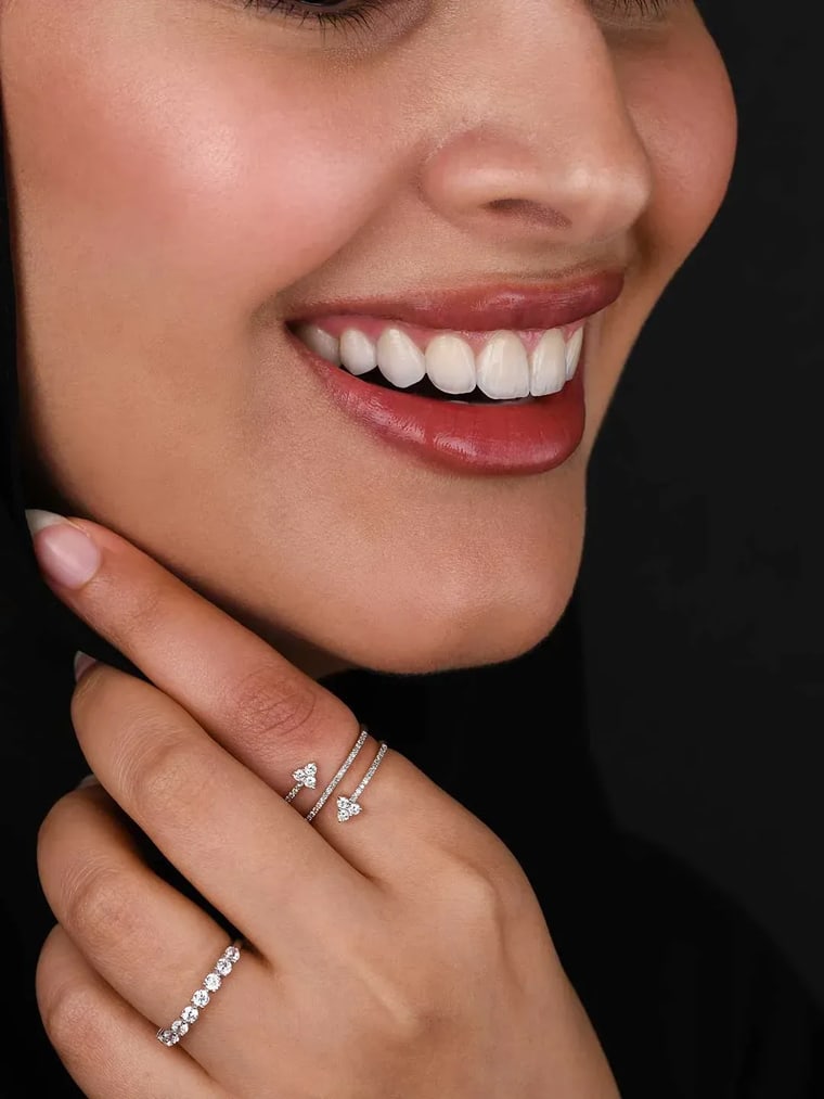 Woman smiling with dental veneers in Dubai
