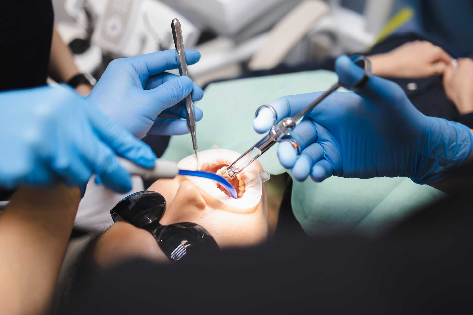 10 Signs You Need to Undergo a Full Mouth Rehabilitation