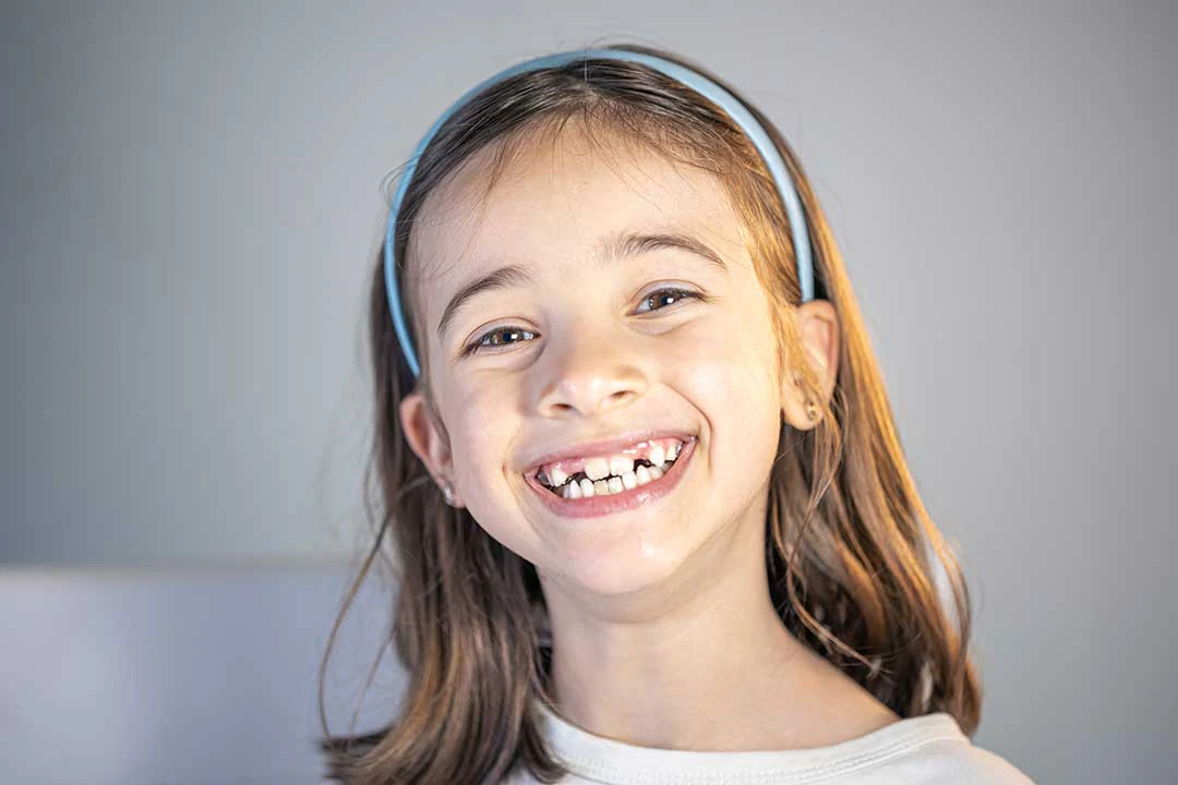 What Are the Common Bite Problems in Children?