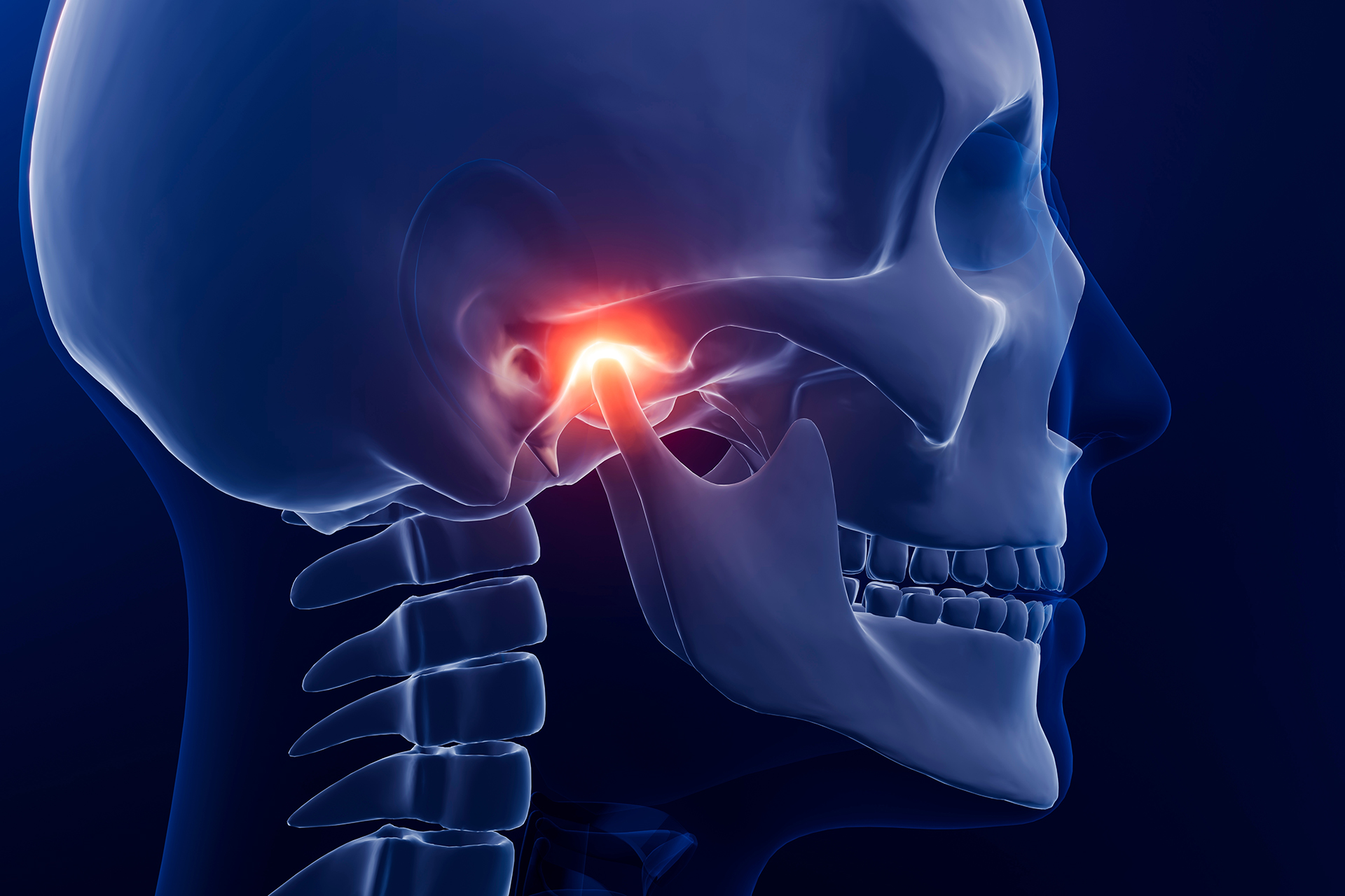 TMJ Disorders: Causes, Symptoms, Diagnosis &Treatment
