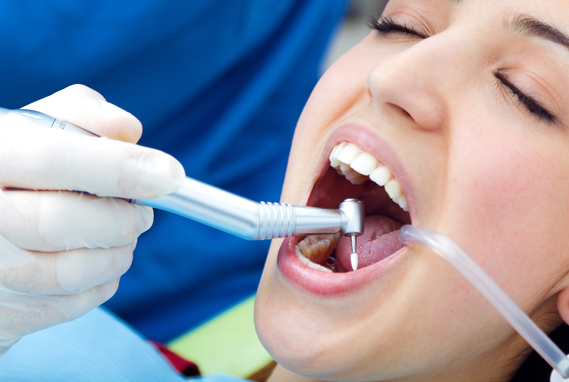 Tooth Extraction Recovery Timeline: What to Expect Each Day?