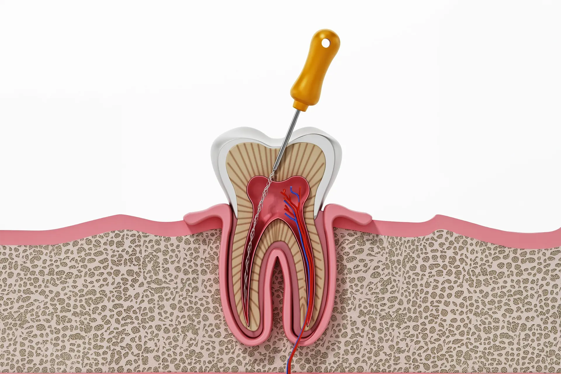 What is a Root Canal Treatment?: Procedure & Recovery