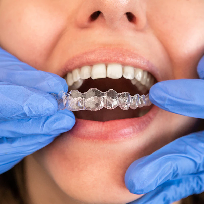 invisalign abu dhabi
