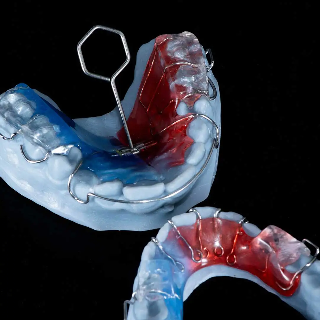 Twin Block Appliance: A Powerful Solution for Jaw Alignment