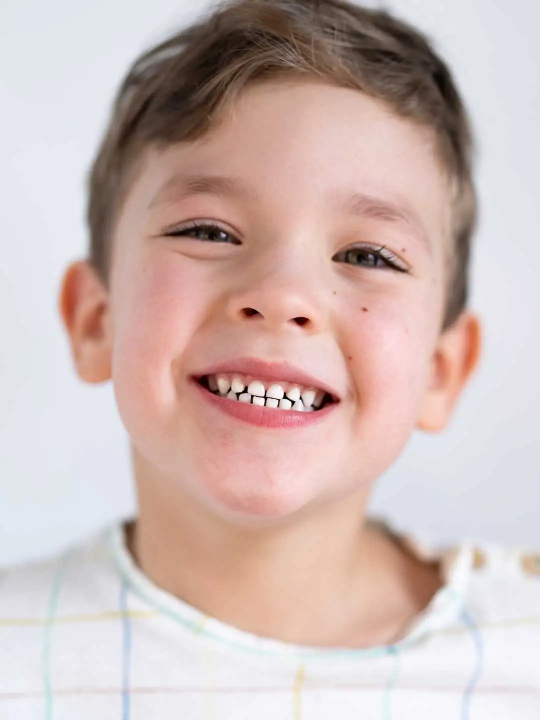 Palatal Expanders