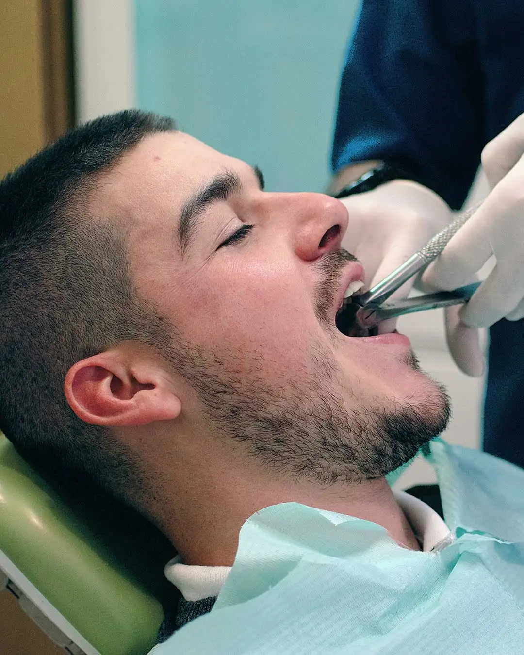 A photo of a man sitting relaxed on a dental chair while having his tooth extracted