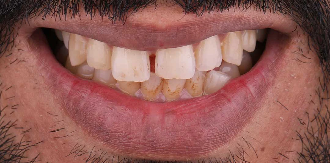 Dr rabee dayoub dentist near me