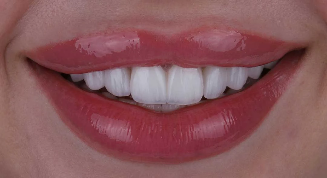 Russian dentist in dubai