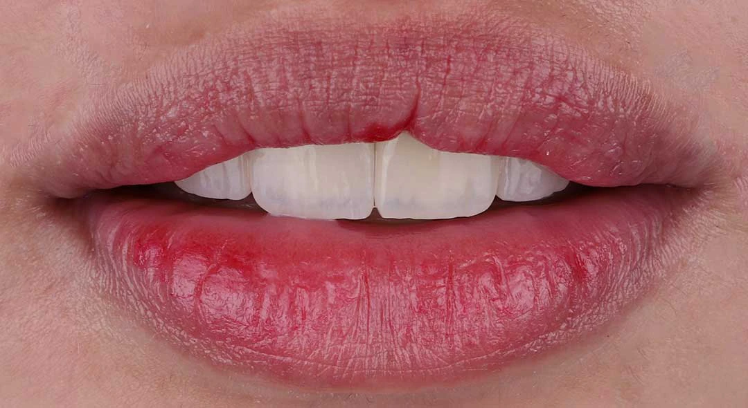 dental clinic jumeirah