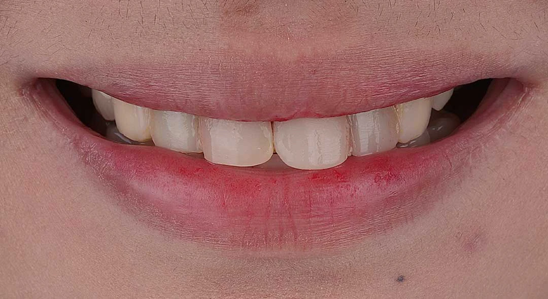 jumeirah dental clinic