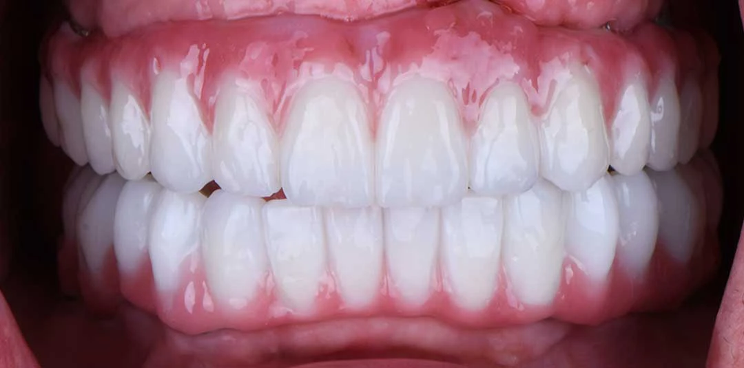 full mouth rehabilitation near me