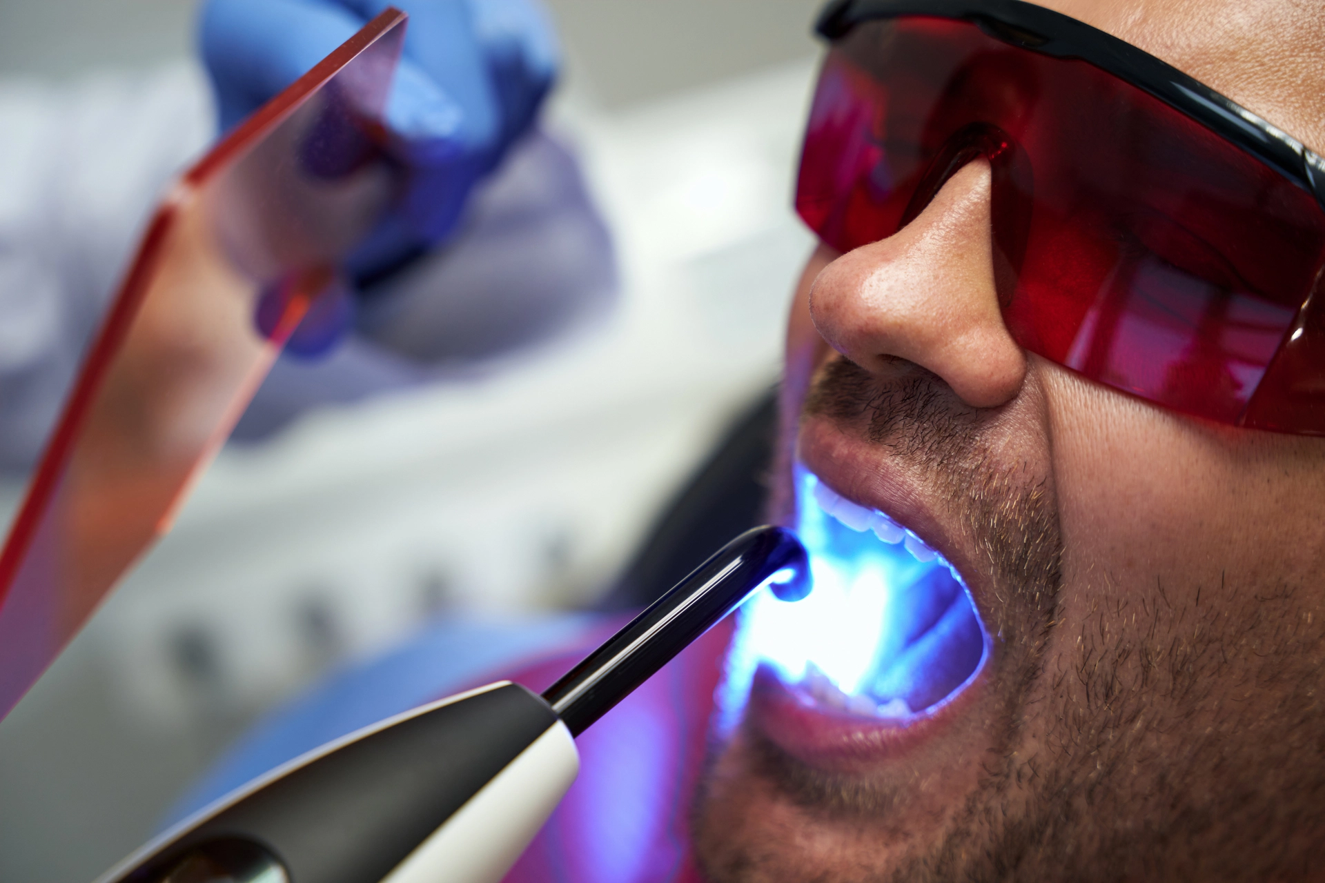 What Is Laser Dentistry? Laser Dentistry Near Me