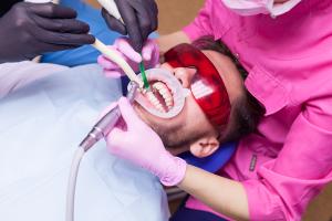 Scaling and polishing offer