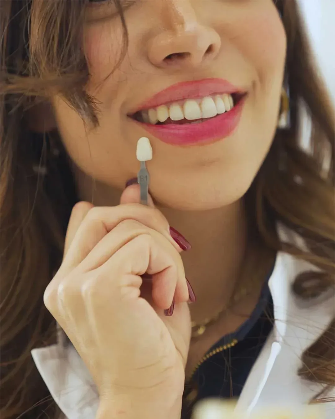 طب الأسنان التجميلي