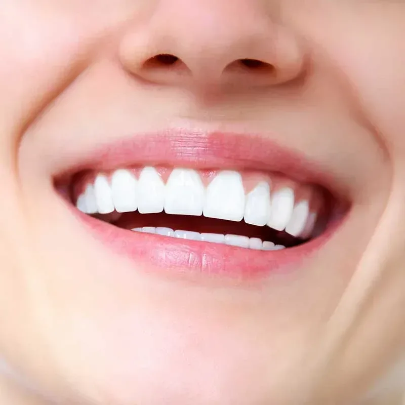 Child dental crown procedure icon