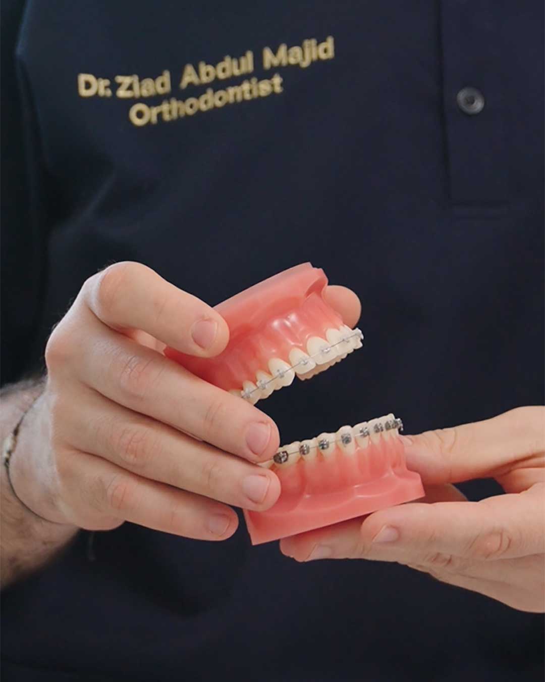 Orthodontics treatment in dubai - abu dhabi - Harmony Medical Center