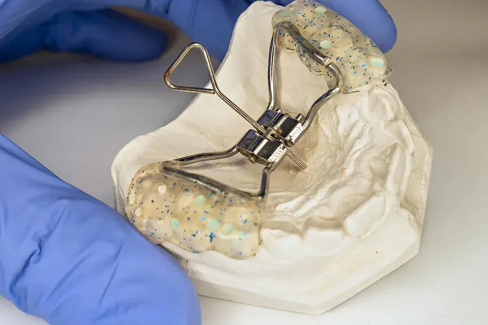 Orthodontic Expanders dubai