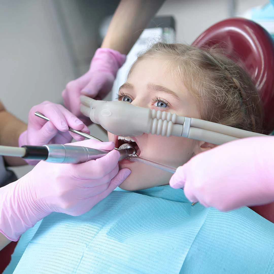 Young girl receiving dental treatment under laughing gas sedation at Harmony Medical Center.