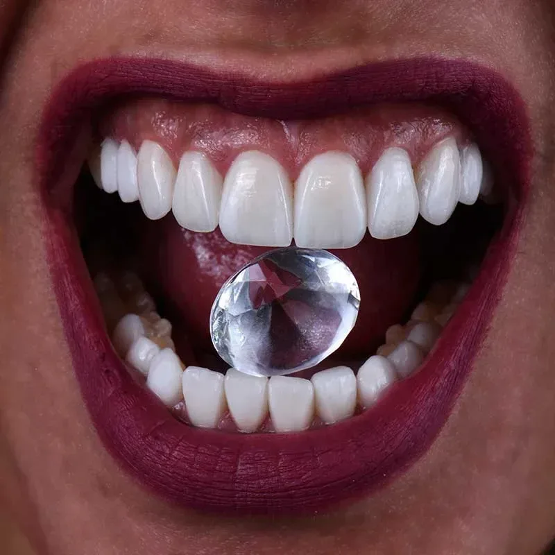 prosthodontics treatment in dubai and abu dhabi