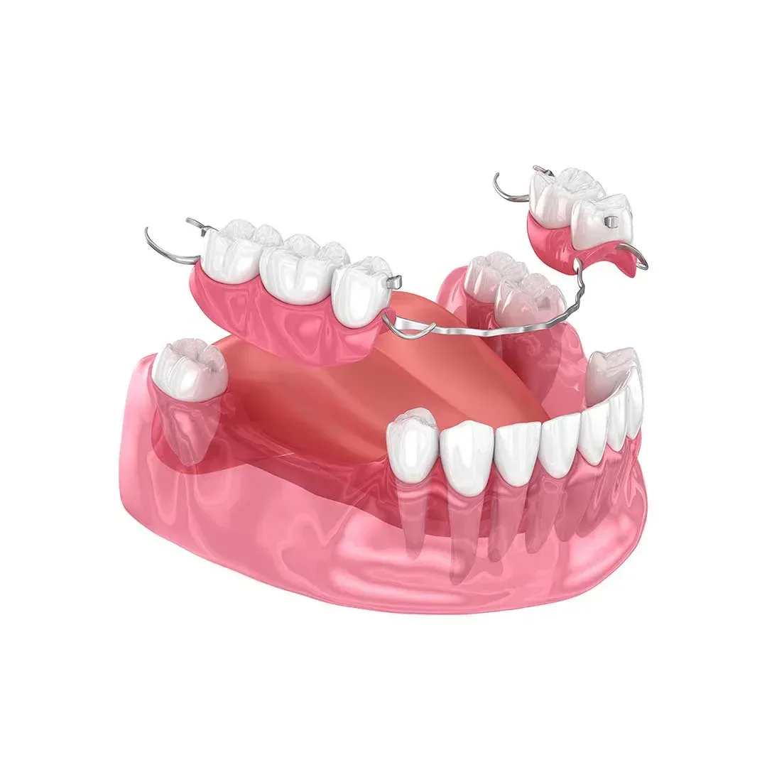 Removable dentures complete and partial options