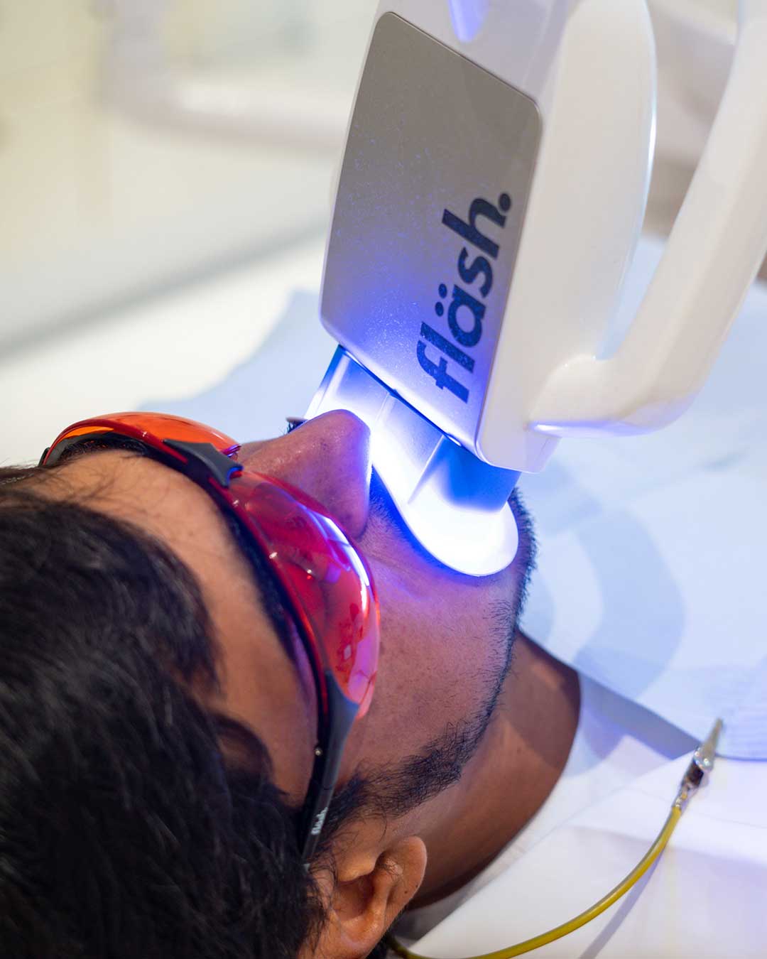 Teeth whitening treatment in dubai and abu dhabi at Harmony Medical Center