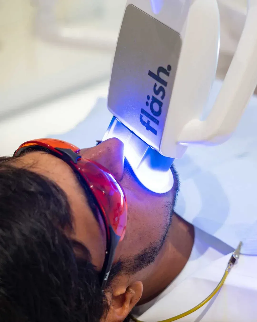 Teeth whitening treatment in dubai and abu dhabi at Harmony Medical Center