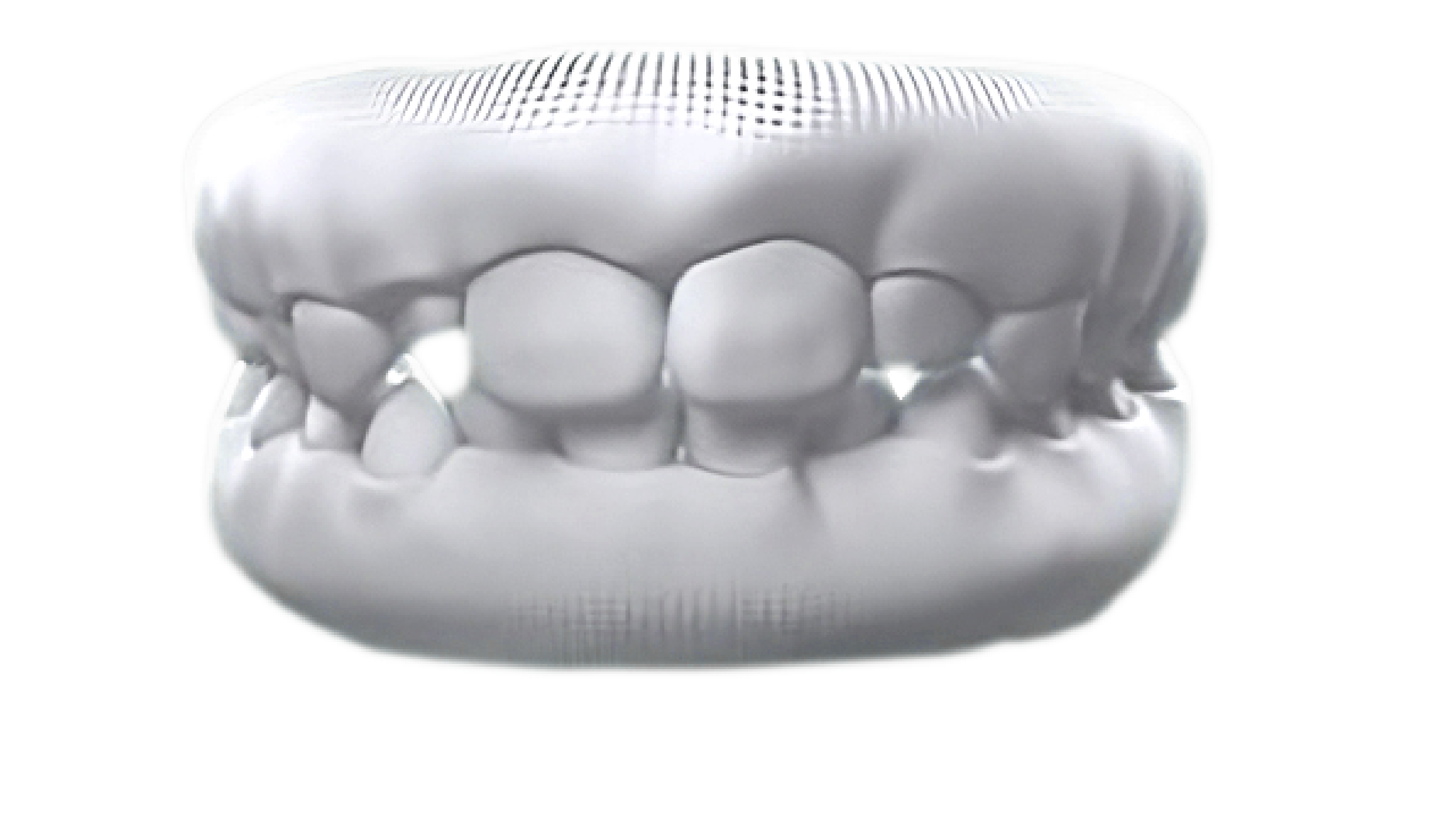 Crooked teeth case photo