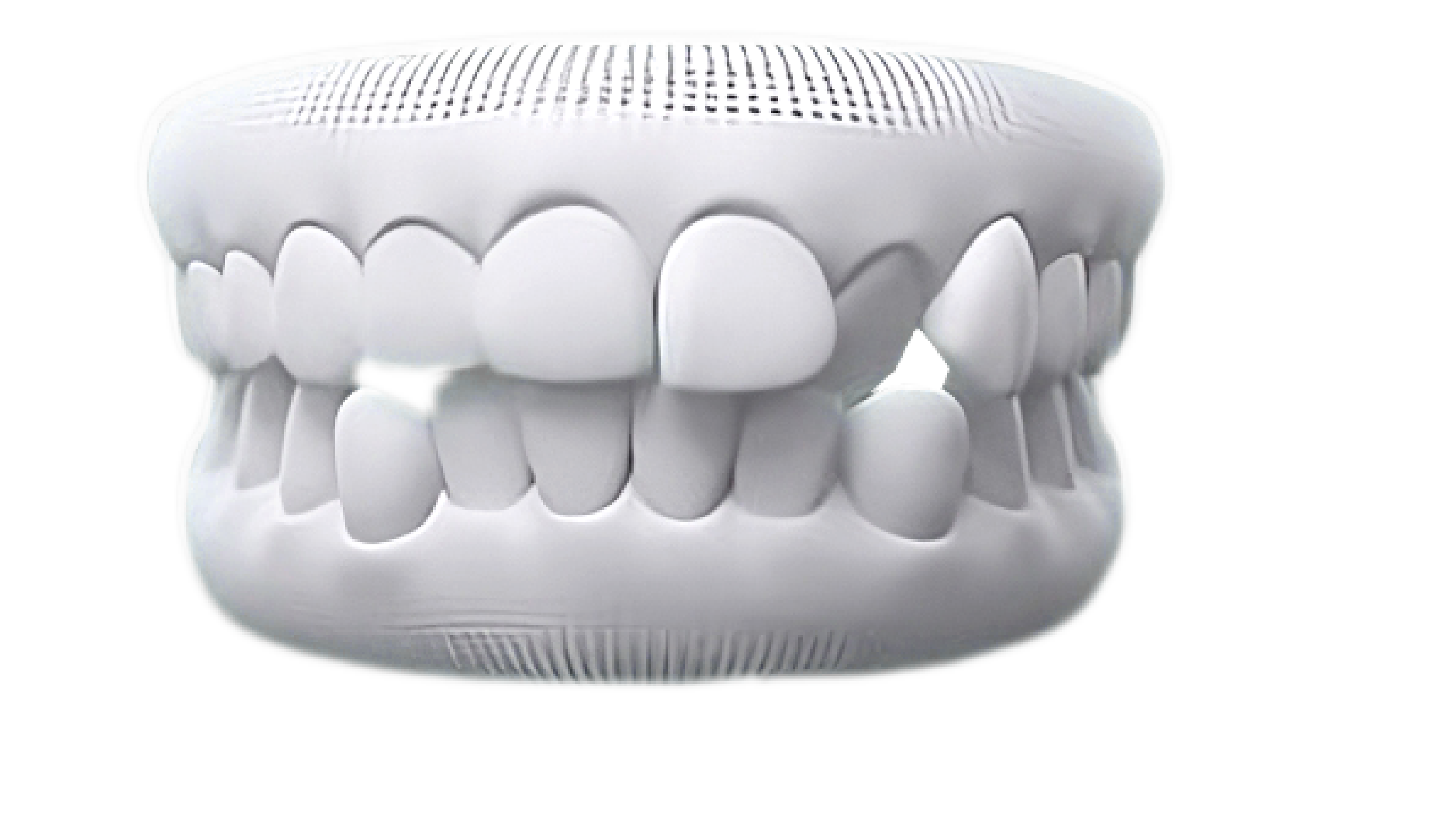 Crossbite case photo