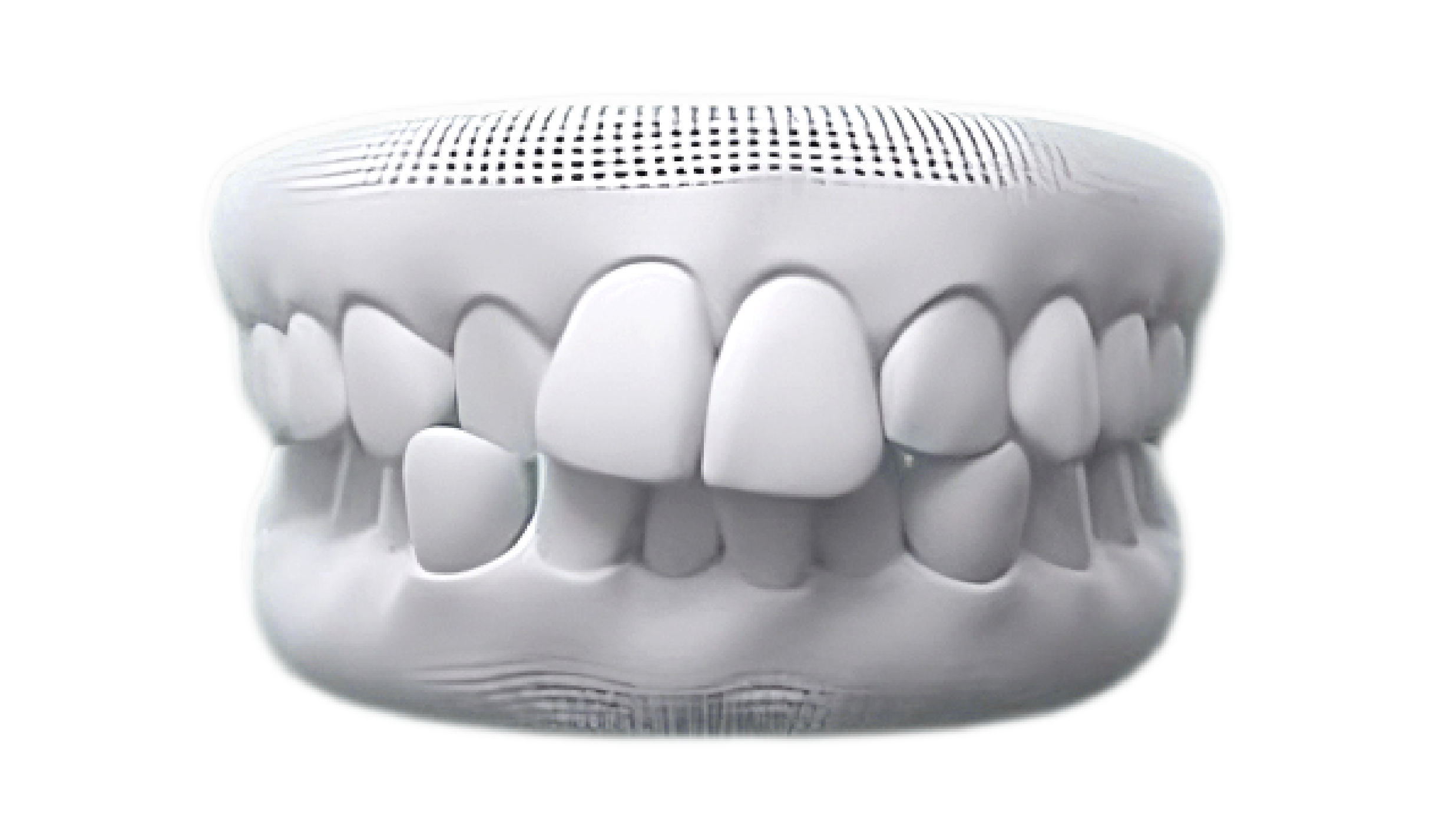Crowded teeth case photo