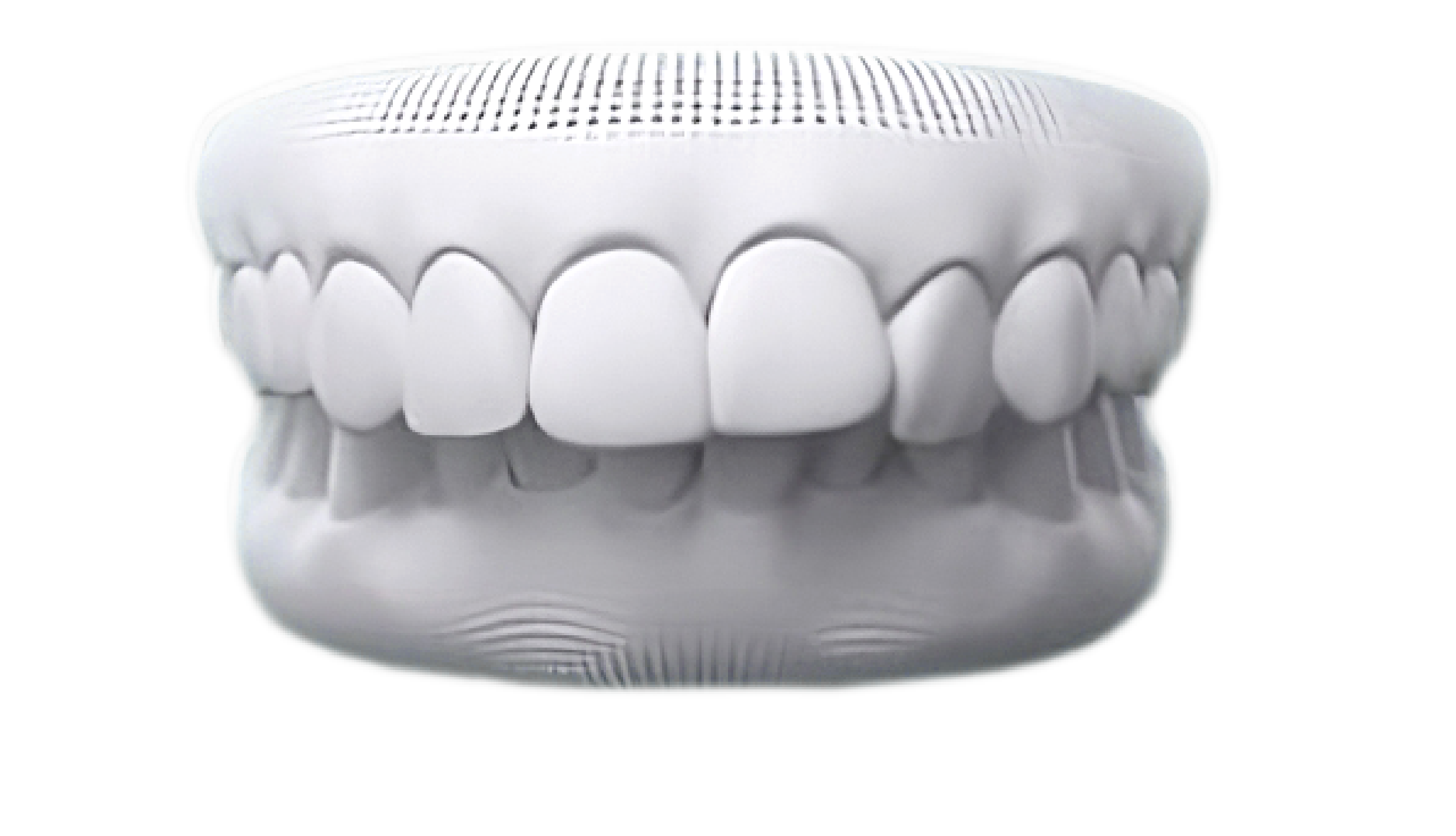 Deep bite case photo