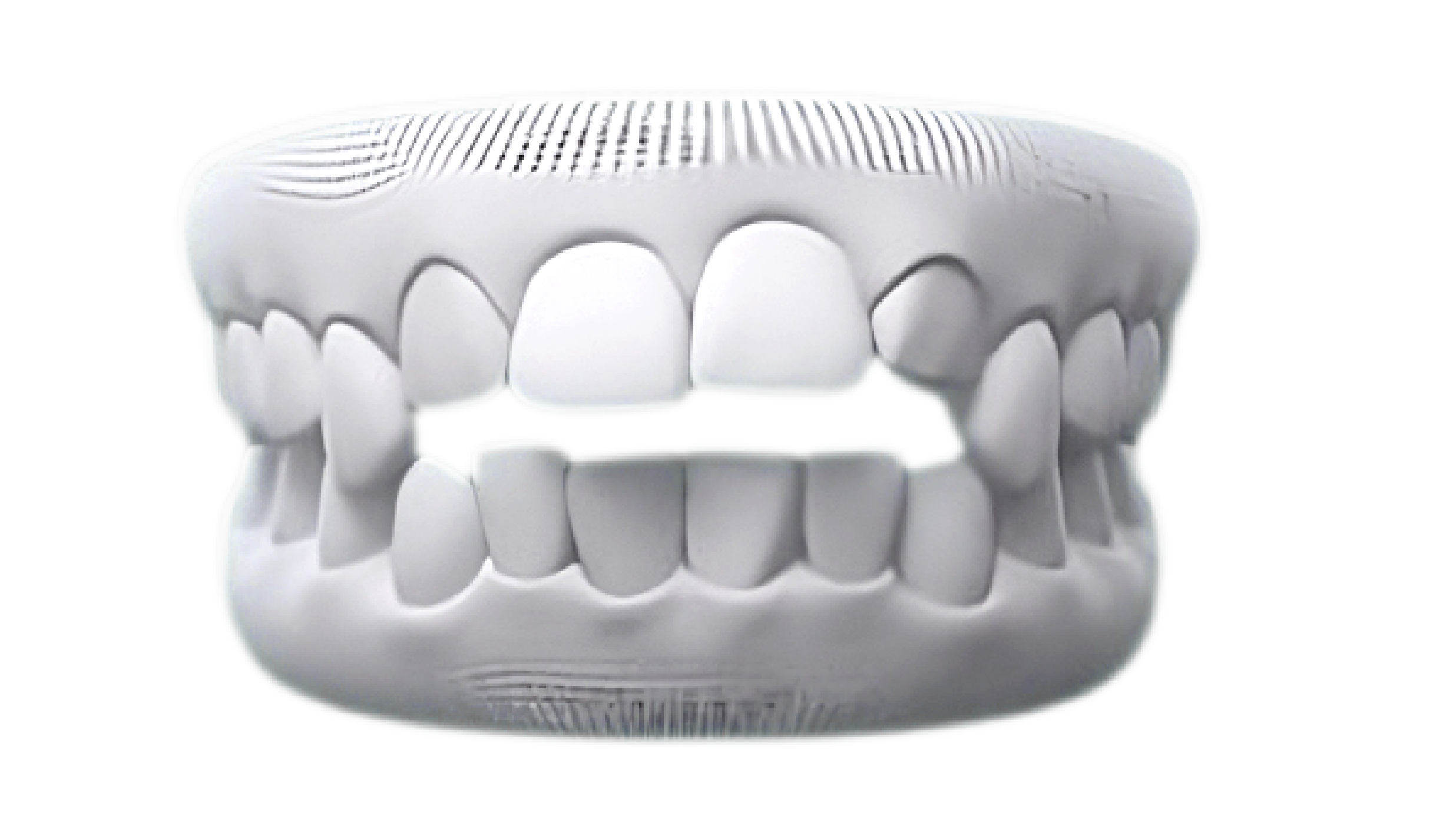 Open bite case photo