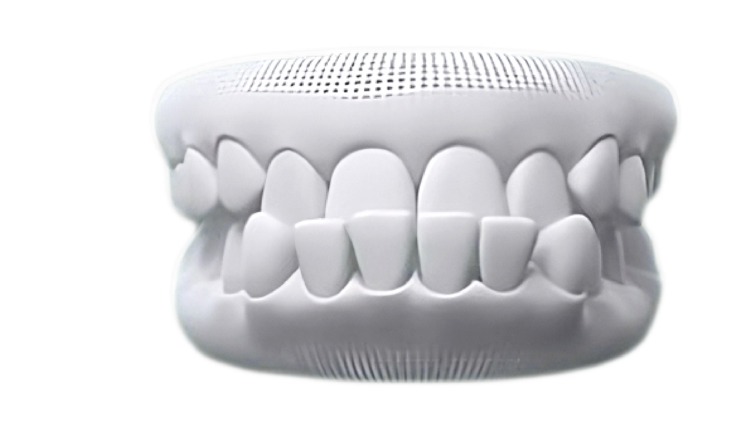 Underbite case photo